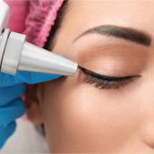 drives the laser market